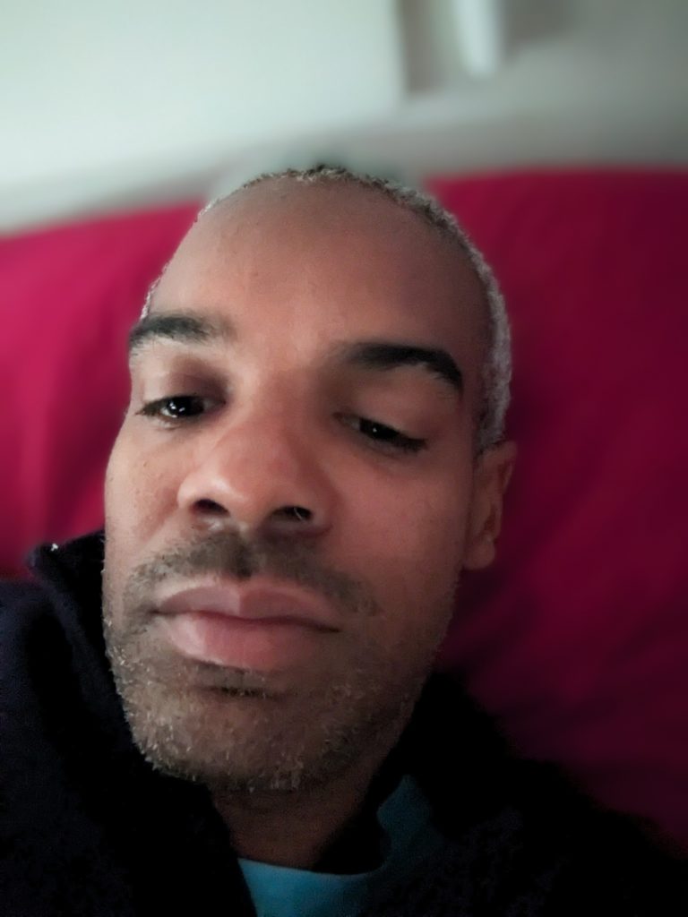 Image of face of unshaven manm