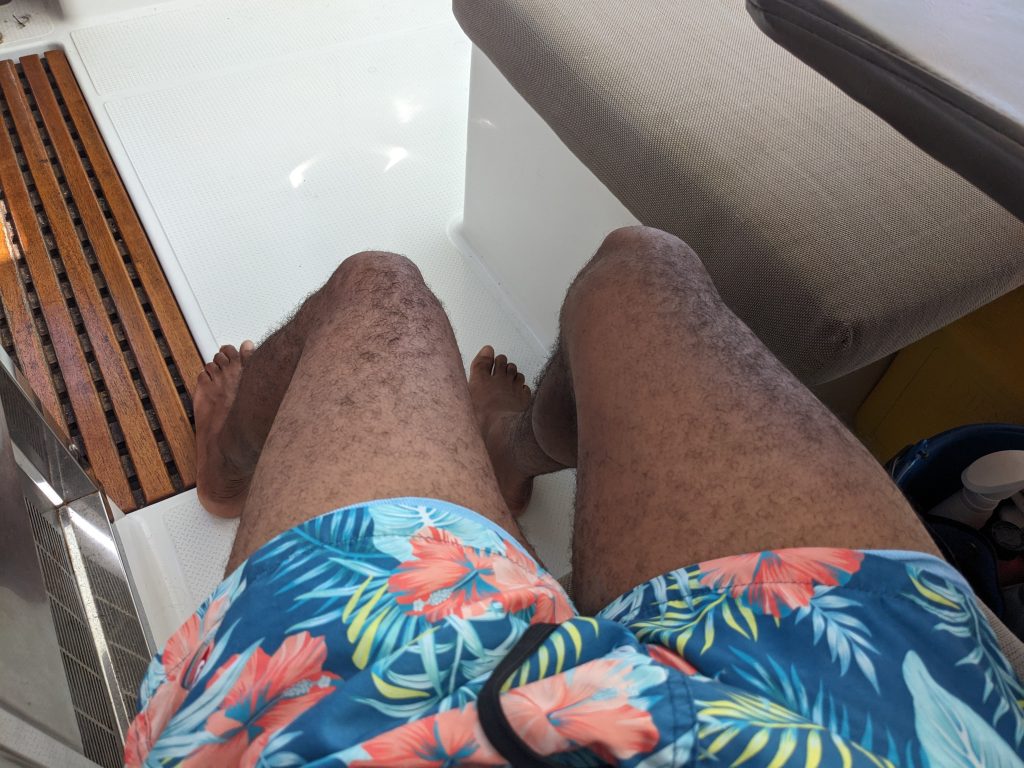Image of a man's hairy legs, jutting out from tropical swimming trunks